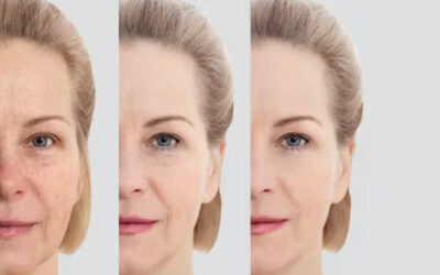 Ozempic Face: Tips to help facial volume loss and re-build collagen